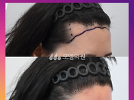 [20대 여자 울퉁불퉁한 M..