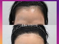 [50대 여자 비대칭 헤어라..