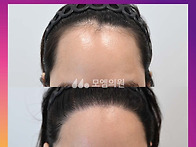 [40대 여자 넓은 비대칭 ..