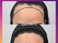 [30대 여자 매우 넓은 M..