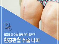 송파 관절 수술병원에서 ..