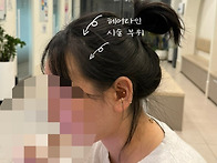 전주헤어라인 고객님 포토..