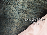 전주두피문신 재시술 받는..