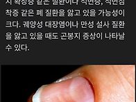 손톱으로 보는 질환