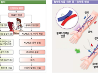 의료비지원 서비스 및 신장이식수술 지원 ..