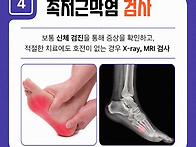 족저근막염 증상, 발바닥 ..