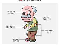 '파킨슨병' 증상, 중증도에 따라 5단계 구..