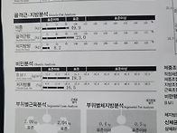러닝 하시는 분들 조심하세..