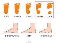 맨발 걷기 운동을 해서는 ..