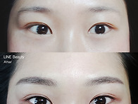 자연스러운4D콤보..