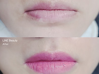 흉터커버입술문신