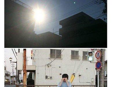 스압) 코털을 순간 접착체로 뽑는 후기와 사진들.jpg