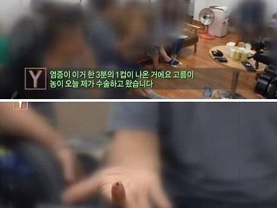 같은 치과의사들도 충격받은 환자상태 ㄷㄷㄷ ..jpg
