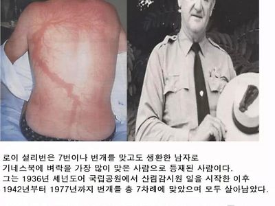 번개7번 맞고도 살아남은 남자도 피하지 못한 것