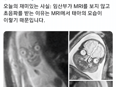 임산부가 초음파를 받는 이유