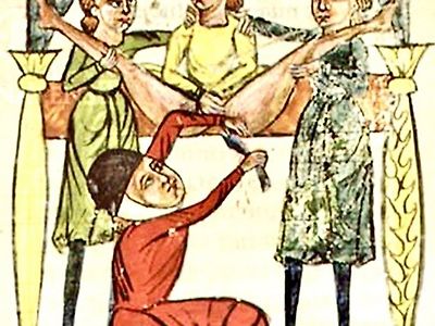 약혐)중세시대 요로결석 수술 방법