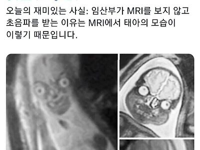 태아 사진을 MRI가 아닌 초음파로 찍는 이유