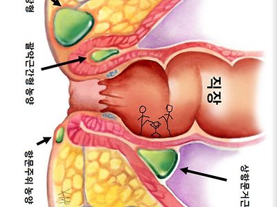 직장 내 괴롭힘