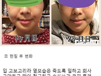 한국에서 7000만원 과금하고간 스시녀