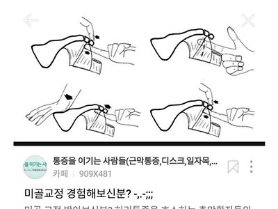 항문에 직접손을 넣어 척추교정하는 미골교정.jpg