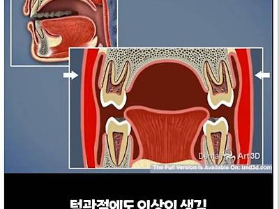 비염의 무서움.jpg6