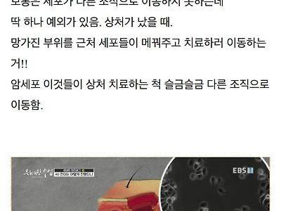 암세포가 몸 속을 이동하는 방법