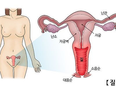 질의 크기는 어떻게 될까?