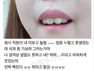 회사 직원이 내 이보고 놀림ㅠㅠ.jpg