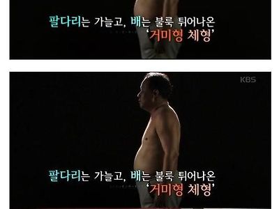 의사들이 지목한 가장 위험한 체형