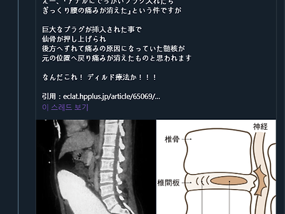 싱글벙글 디스크 치료법