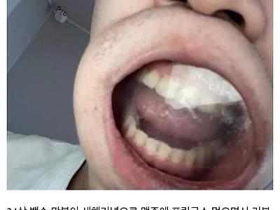 염병하다 ㅈ된 디씨인