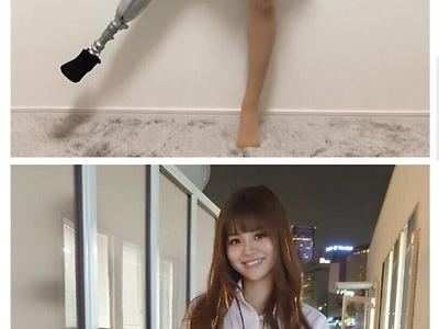 일본의 의족 모델 눈나