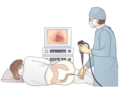 대장내시경 굶고 가면 당일날 가능해?