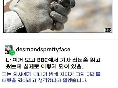 아내에게 헤드샷을 맞고 심한 두통으로 병원에 간 남자1