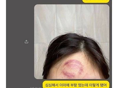 울엄마 존나 비꽈