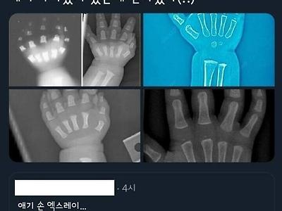 애기들이 통통한 이유