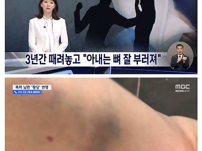 3년간 때려놓고 "아내는 뼈 잘 부러진다" 변명