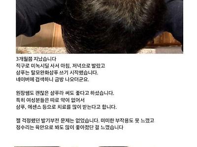성기능 감퇴 없이 탈모 극복한 정수리 탈모인