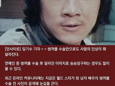 쌍꺼풀 수술만으로 인생이 바뀐 남자..jpg