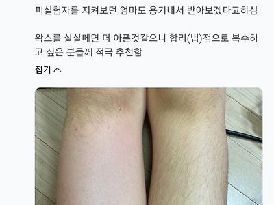 초6 딸내미 왁싱해준 40대 아빠