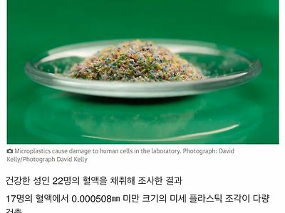 혈관에 미세 플라스틱이 흐른다고?