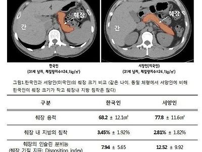 동양인은 죽었다 깨어나도 서양인을 이길 수 없는 것