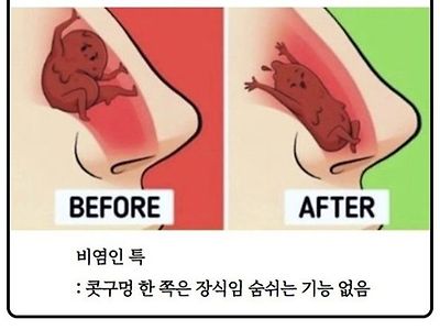 비염인 특징