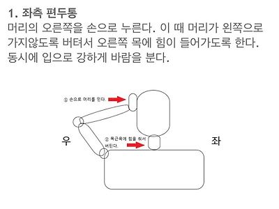 펀두통 치료법