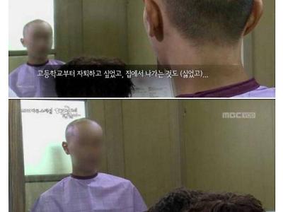 탈모환자가 받는 스트레스