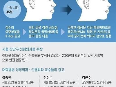 무시무시한 요즘 성형수술
