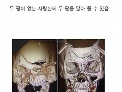 의학의 놀라운발전