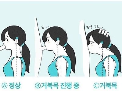 (19)  그림으로 보는 거북목 판별법