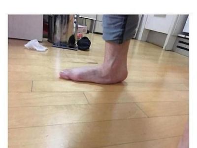 역대급 평발공익.jpg