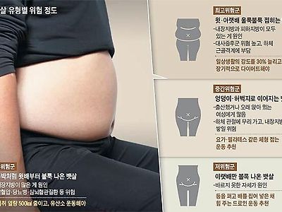 가장 위험하다는 뱃살 유형.....JPG